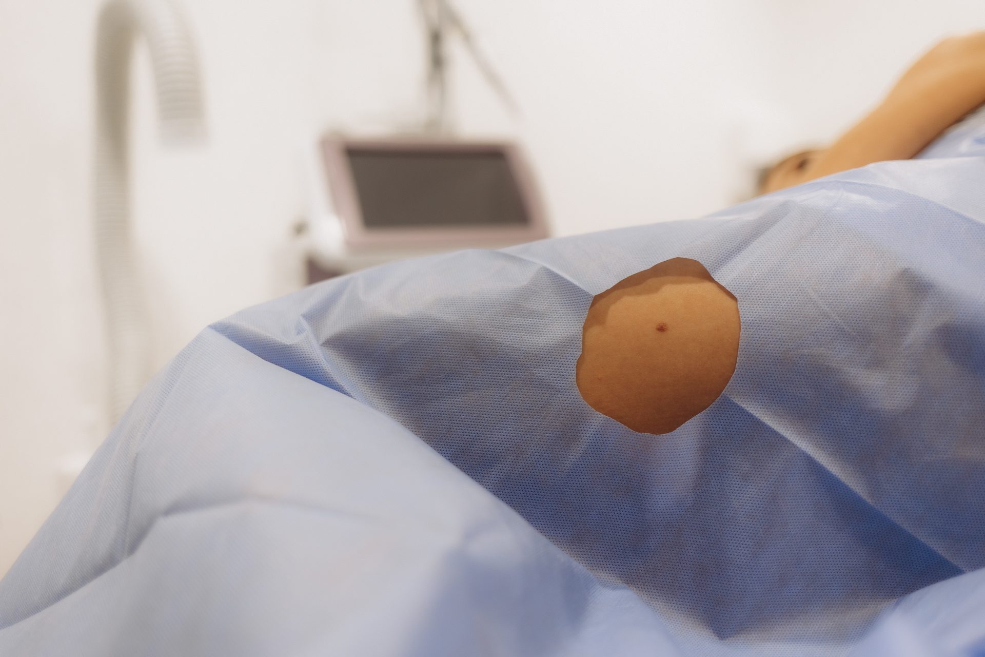 Physician examining skin during a dermatology visit